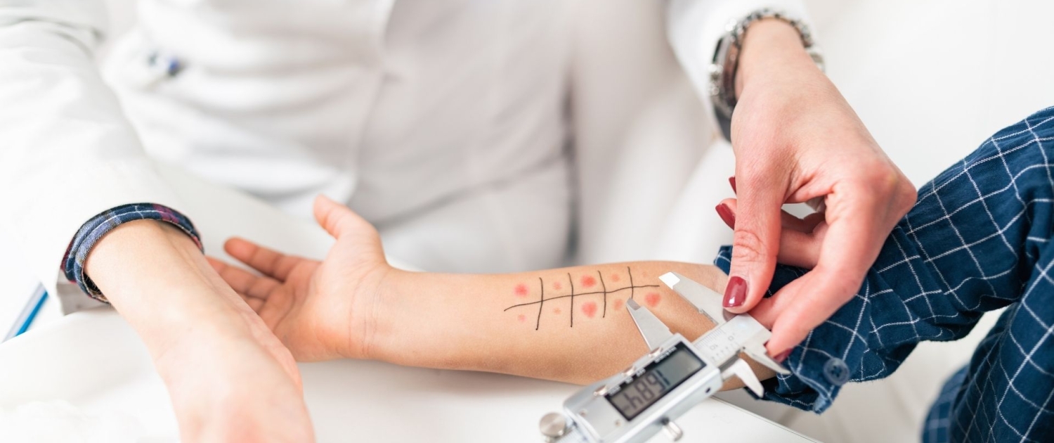 İmmunoloji ve Alerji