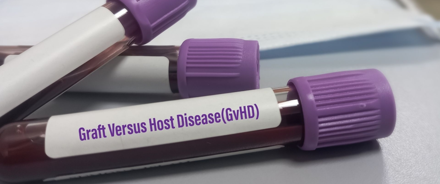 Kemik İliği Nakli Merkezi (Erişkin)